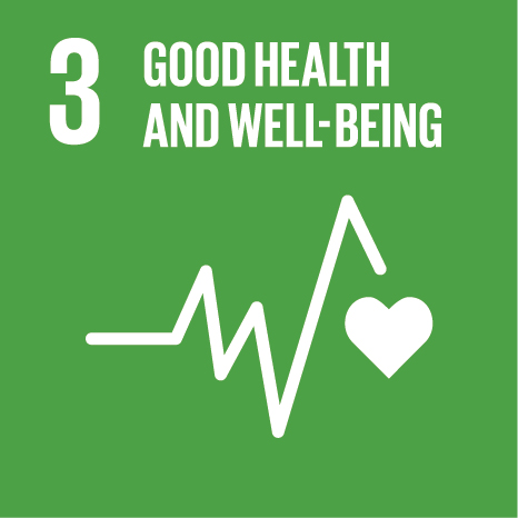 SDG